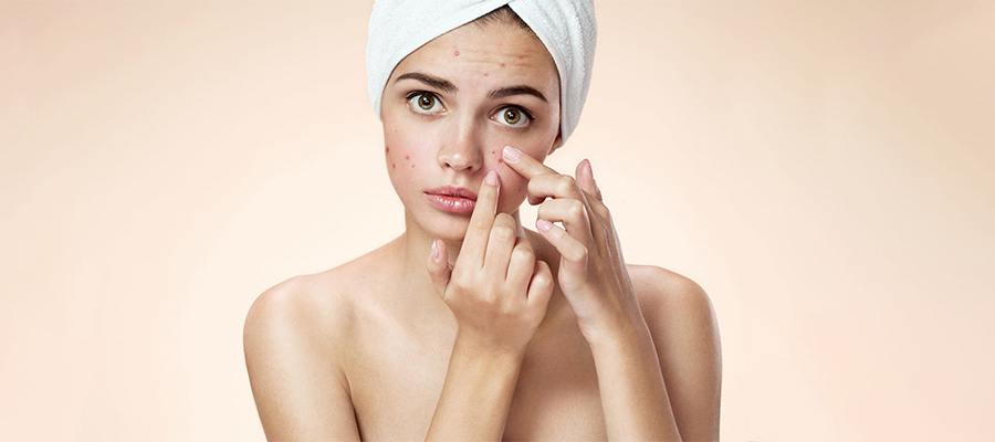 Acne Vulgaris Diagnosis and Treatment