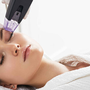 What is Gold Needle (Microneedle Radiofrequency) Treatment?
