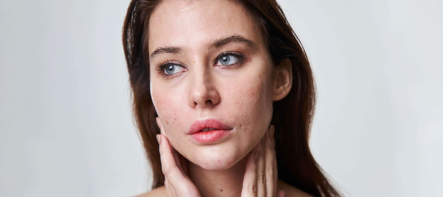 How to Get Rid of Blemishes on Your Face?