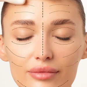 Is Liquid Facelift Effective?