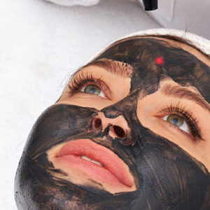 What Is Carbon Peeling Used For?