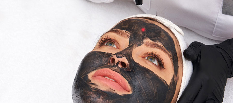 What Is Carbon Peeling Used For?