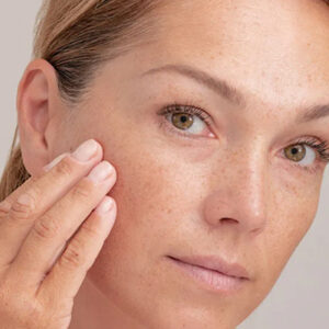 Comment se Débarrasser Des Taches Brunes du Soleil Sur le Visage ?