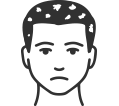 Alopesi Tedavisi