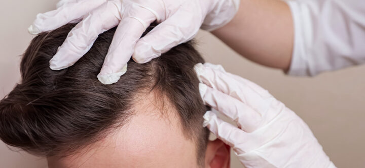 diagnostic-et-traitement-des-maladies-des-cheveux-et-du-cuir-chevelu Diagnostic et Traitement des Maladies des Cheveux et du Cuir Chevelu