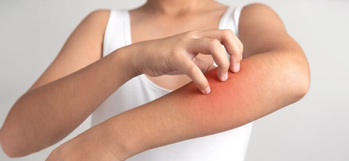 diagnostic-et-traitement-des-maladies-fongiques Diagnostic et Traitement des Maladies Fongiques