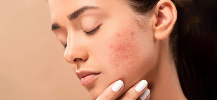 What-Is-a-Spot-How-Is-Spot-Treatment-Done What Is a Spot? How Is Spot Treatment Done?