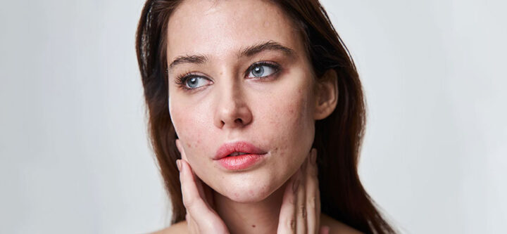 Comment se débarrasser des imperfections sur votre visage Comment se débarrasser des imperfections sur votre visage