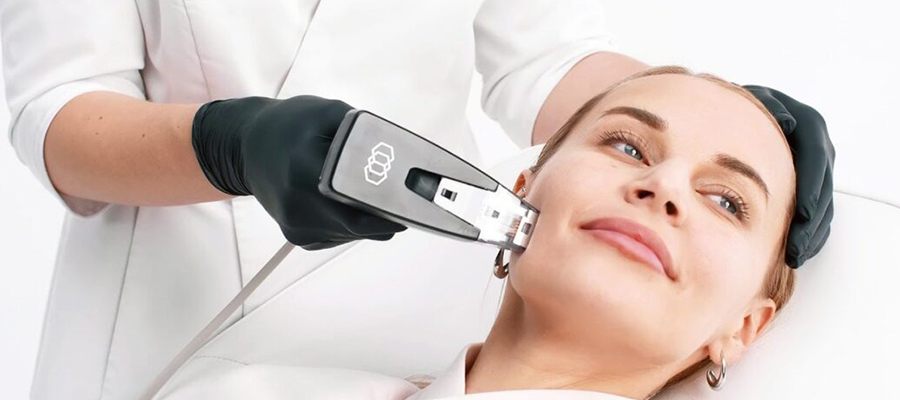 Morpheus 8 Etkisi Ne Kadar Sürer ?