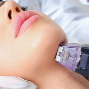 Altın İğne İşe Yarıyor Mu ?